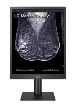 Monitor Diagnostico Lg 21" 4:3 3Mpx 21Hq513D